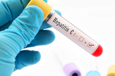 Медпомощь заболевшим гепатитом С выросла в два раза на Ставрополье